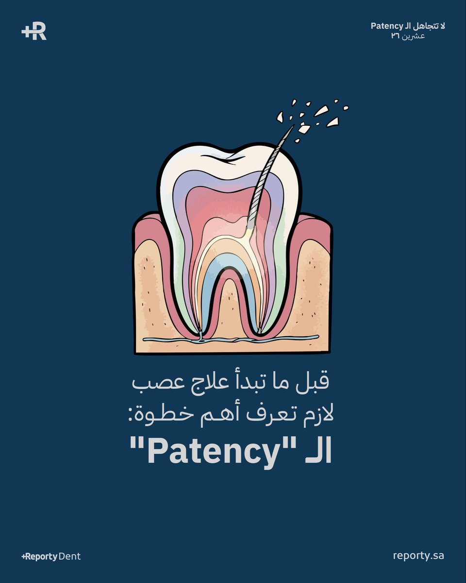 reportydent's tweet photo. المراجع يدخل عليك، الألم موجود، الأشعة باينة، وتقول خلاص أفتح وأسوي RCT 🛠️ 

لكن أول ما تدخل بالأداة للـ WL، تبدأ التعقيدات تواجهك، وهنا يبان إذا تعرف تسوي Patency صح ولا لا 🤔

أيش المقصود بـ Patency ؟ 🧵

بكل بساطة إنك تحافظ على القناة سالكة لنهاية الـ foramen بأداة صغيرة (عادة #10 أو #08) بدون ما توسّع، وبدون ما تدفّع

والهدف أنك تمنع أي إنسداد لل debris، وتضمن إن تنظيفك يوصل للنهاية الصحيحة

فين تبدأ المشكلة ؟ ⚠️

– الأداة توقف قبل WL
– أو تحس إنها “تعلق”
– أو تبدأ debris تتجمع
– أو يحصل ledge بسيط بدون ما تنتبه

*هنا المراجع ما يعرف لكن أنت المفروض توقف وتحل المشكلة قبل تكمل

أكثر الأسباب اللي تخرب الـ Patency 🚫

دخولك القناة بدون Glide Path
إستخدامك أداة كبيرة بدري
عدم تنظيف الأداة باستمرار
إهمال الـ irrigation
ضغطك للأداة بدل ما تخليها تمشي مع المسار

أيش الأشياء اللي “ممنوع” تسويها ؟ ⛔️

لا تعاند الأداة إذا كانت تعلق
لا تزيد ضغط فقط “عشان تمشي”
لا توسّع قبل ما تتأكد من المسار
لا تكمّل العلاج وأنت فاقد الـ patency
لا تعتمد على الروتاري لو الـ hand file مو ثابت

*ضروري ما تكابر في الأشياء هذه عشان تتجنب أي ledge أو block

أيش المفروض تسوي ؟ ✅

أرجع لملفات #06–#08–#10
أستخدم watch winding خفيف
زوّد irrigation كثير
عيد تقييم الـ WL
أفتح السوبر كورونا أقل لو أحتجت
مشّي الأداة بهدوء بدون أي force

*اللي يضبط الـ Patency مضبوط نادر جداً يدخل في مشاكل

متى توقف العلاج ؟ 🔴

– WL قاعد يقصر بدون سبب
– الأداة معلّقة في نفس النقطة
– القناة شكلها مو واضح
– أو حاس إنك بدأت تصنع مسار غلط

أخيراً 🏁

الـ Patency مو خطوة إضافية، لا هي أساس نجاح الـ RCT إذا ما تعرف تتصرف لما القناة “تقفل” لا تشتغل علاج عصب لأن root canal بدون patency = مشاكل، ألم، وفشل علاجي ما له داعي

الـ Patency هي أساس العلاج إذا فقدتها كل خطوة بعدها تكون مبنية غلط، ضروري تتعلمها وتتقنها، وتوقف العلاج لو حسّيت إنك خرجت عن المسار 🧵⚠️