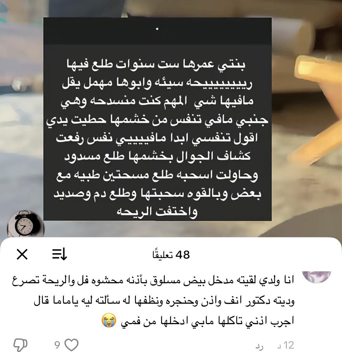 اجرب اكل من اذني !!😭😭😭
