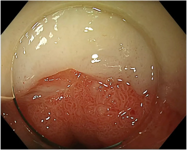 VideoGIE Journal tweet media