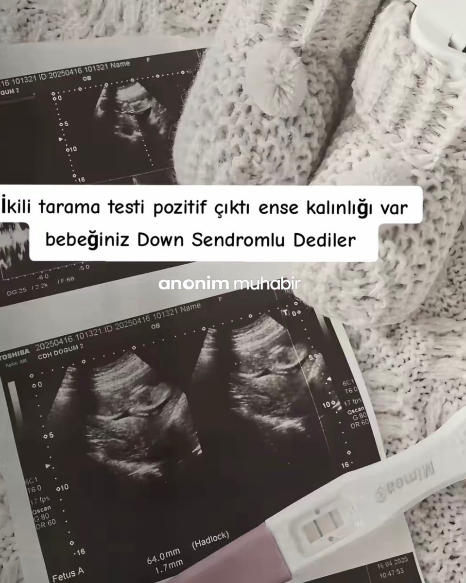 Anonim Muhabir tweet media