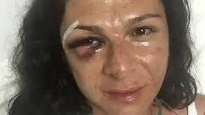 <a href="/Matador000/">matador 🇪🇭</a> Eh aquí,tus dos grandes obras maestras.👇
CAREVERGA!!