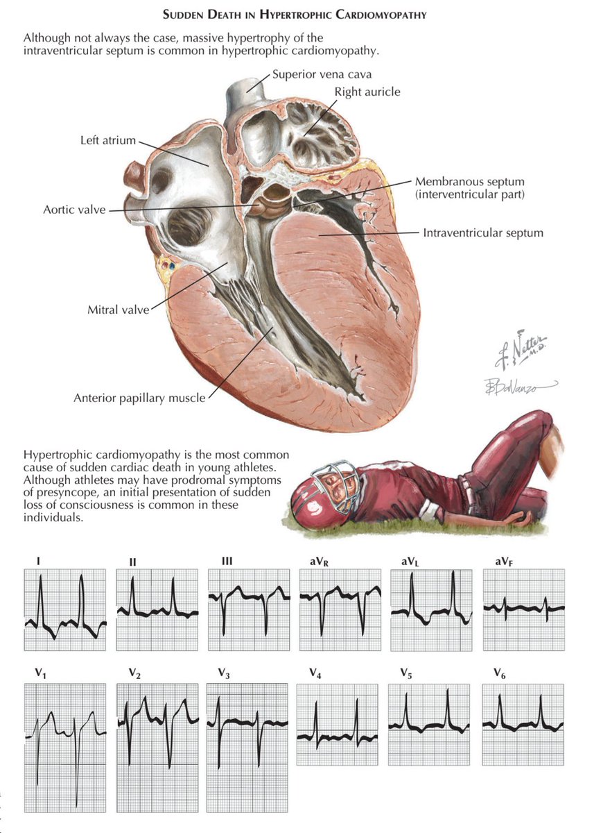TrackYourHeart tweet picture