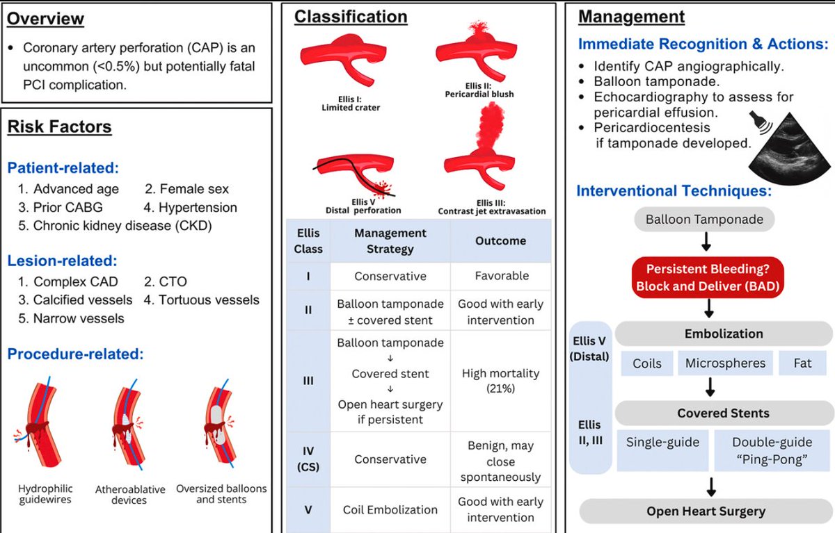 frahman480's tweet image. Quick summary for all our #IC interventional fellows - #coronaryperforations in @JACCJournals #casereports jacc.org/doi/10.1016/j.…