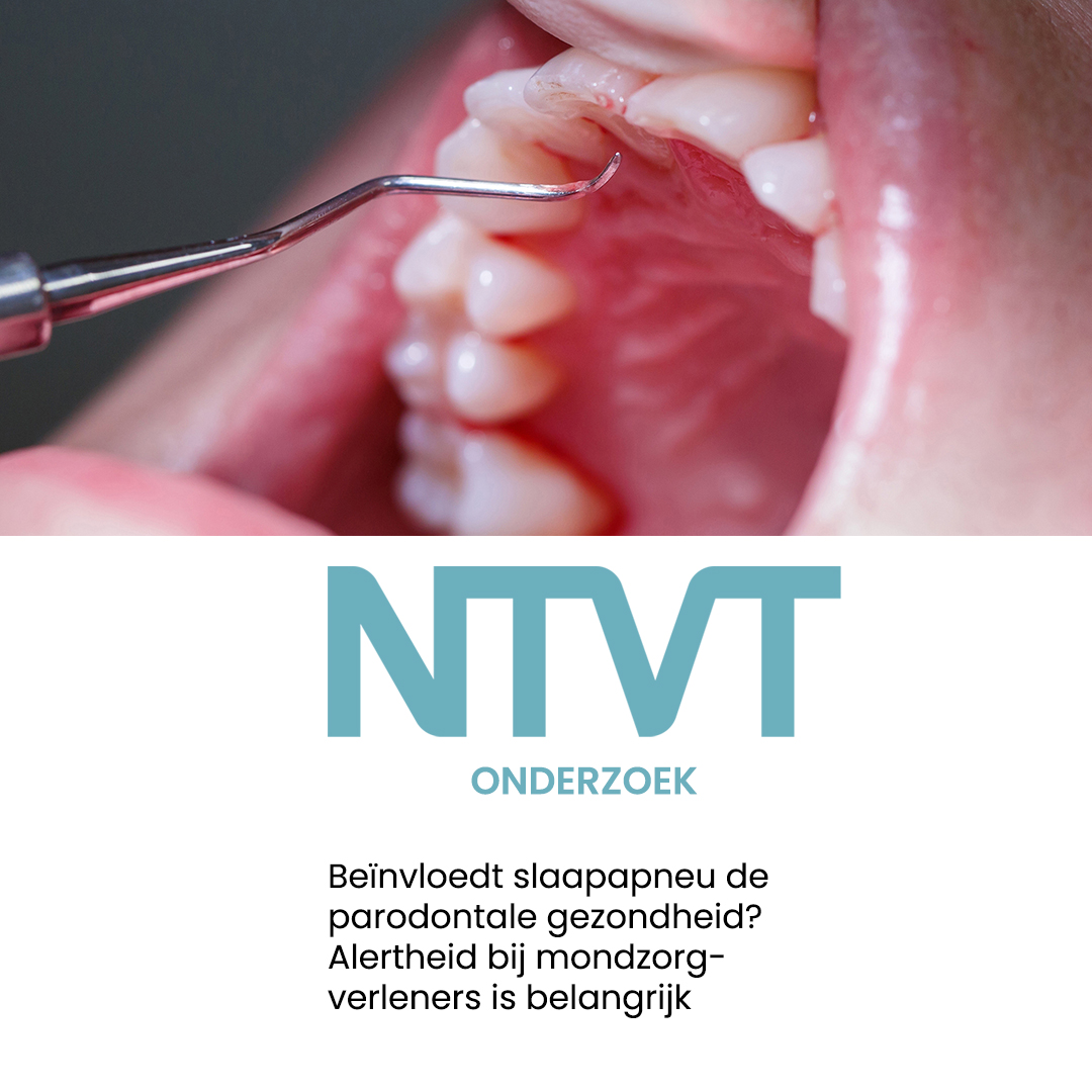 NTVTredactie's tweet image. Volwassenen met obstructieve slaapapneu lijken vaker een verminderde parodontale gezondheid te hebben. 

Lees meer: doi.org/10.5177/ntvt.2… #OSAS #parodontologie #mondzorg 

#tandheelkunde #gezondheid