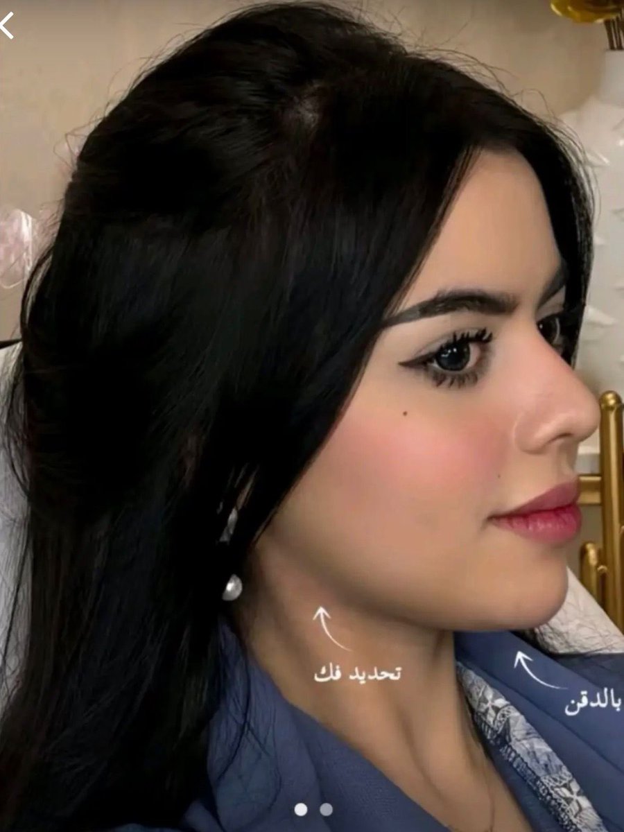 Golden Dose tweet media