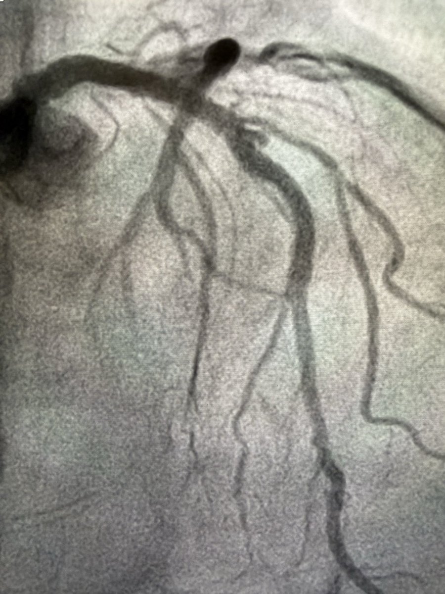 Aditya Mandawat, MD tweet media