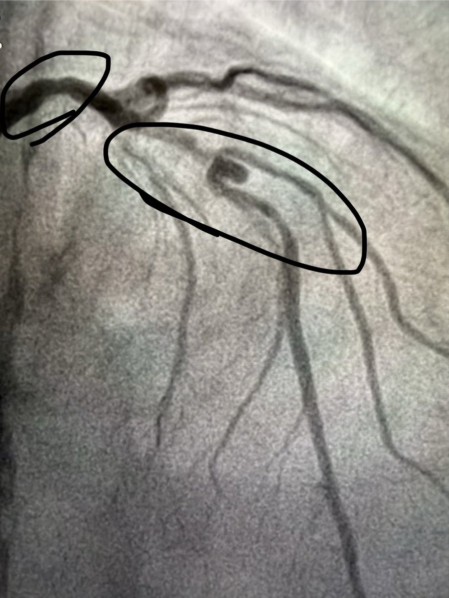 Aditya Mandawat, MD tweet media