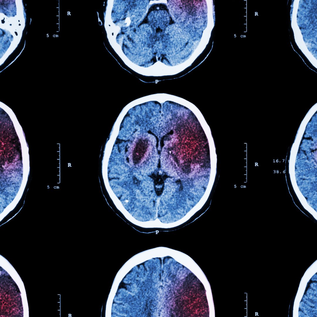 PrestigeRadiol1's tweet photo. Radiology is the cornerstone of modern diagnostics. We combine cutting-edge tech with expert interpretation for trusted results. Contact us and schedule our imaging services today. #Radiology
https://t.co/VspelOkvhr https://t.co/UTG28CYPHJ