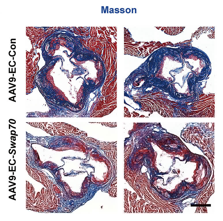 Circulation Research tweet media