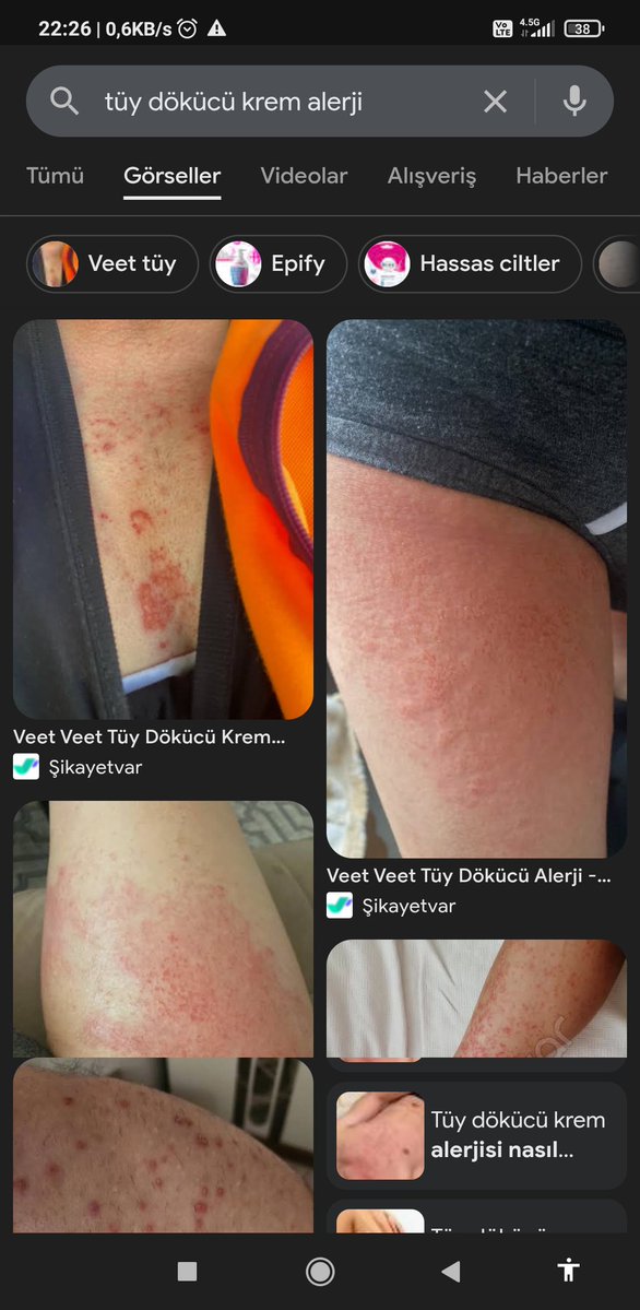 Veet men duşta tüy dökücü krem kullandım. Her kurala uydum ama her yerim kabardı. İnternete "tüy dökücü krem alerji" yazdım binlerce şikayet var. Nasıl hala satabiliyorsunuz?