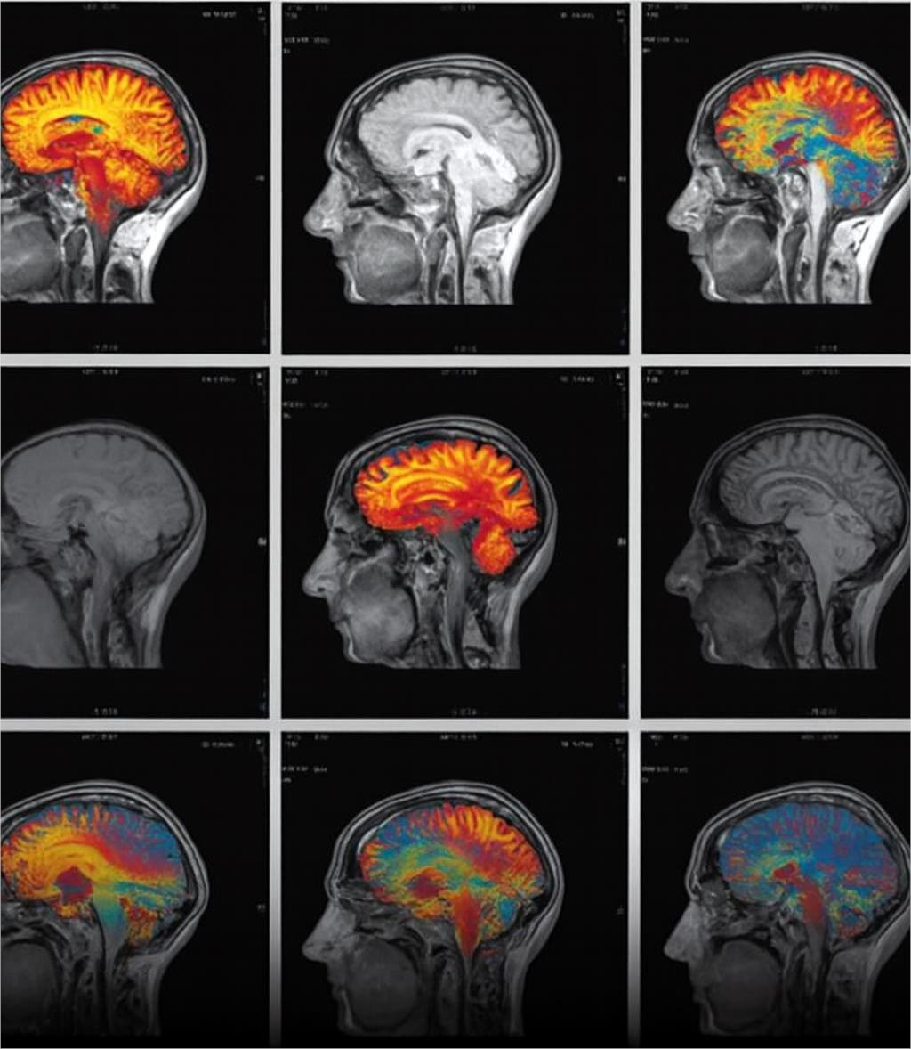 🚨: Women who wore rose essential oil on their clothes for just 30 days showed significant increase in grey matter volume across the whole brain on MRI scans