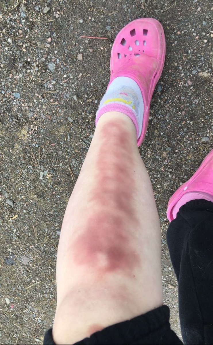 Eli★they/she tweet media