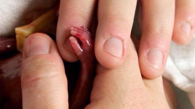 All Life Matter
Take my Hand NOT my Life
<a href="/FernandoChomali/">Card. Fernando Chomali</a> <a href="/maylwino/">Mariana Aylwin</a> 
@EdwardoFrei <a href="/Karenci75407460/">Karen Medina Diputada</a> 
<a href="/hectorbarria/">Hector Barria Diputado✌🏽</a> <a href="/BarriosDiputado/">Diputado Arturo Barrios</a> 
<a href="/soledadalvear/">Soledad Alvear</a> 
WorldWide Rosary 0n 17th 
Of May  2026: I am Life!!!