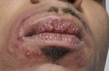 🍀LUCKY $EVEN🍀 tweet media