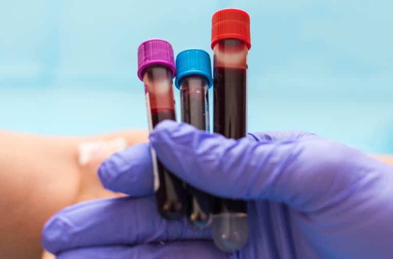 د. يوسف ال زاهب tweet media