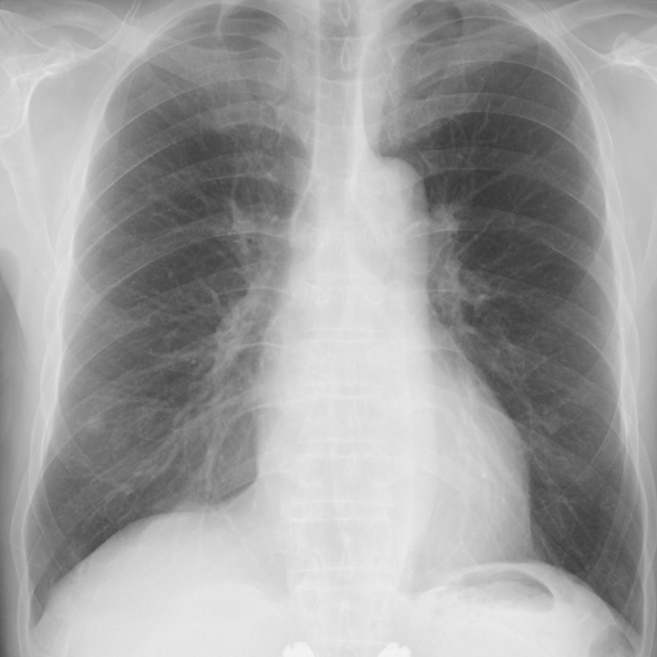 lung-dr | 呼吸器内科医 tweet media