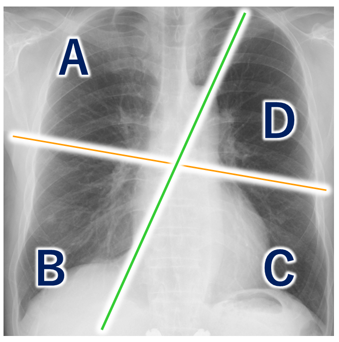 lung-dr | 呼吸器内科医 tweet media