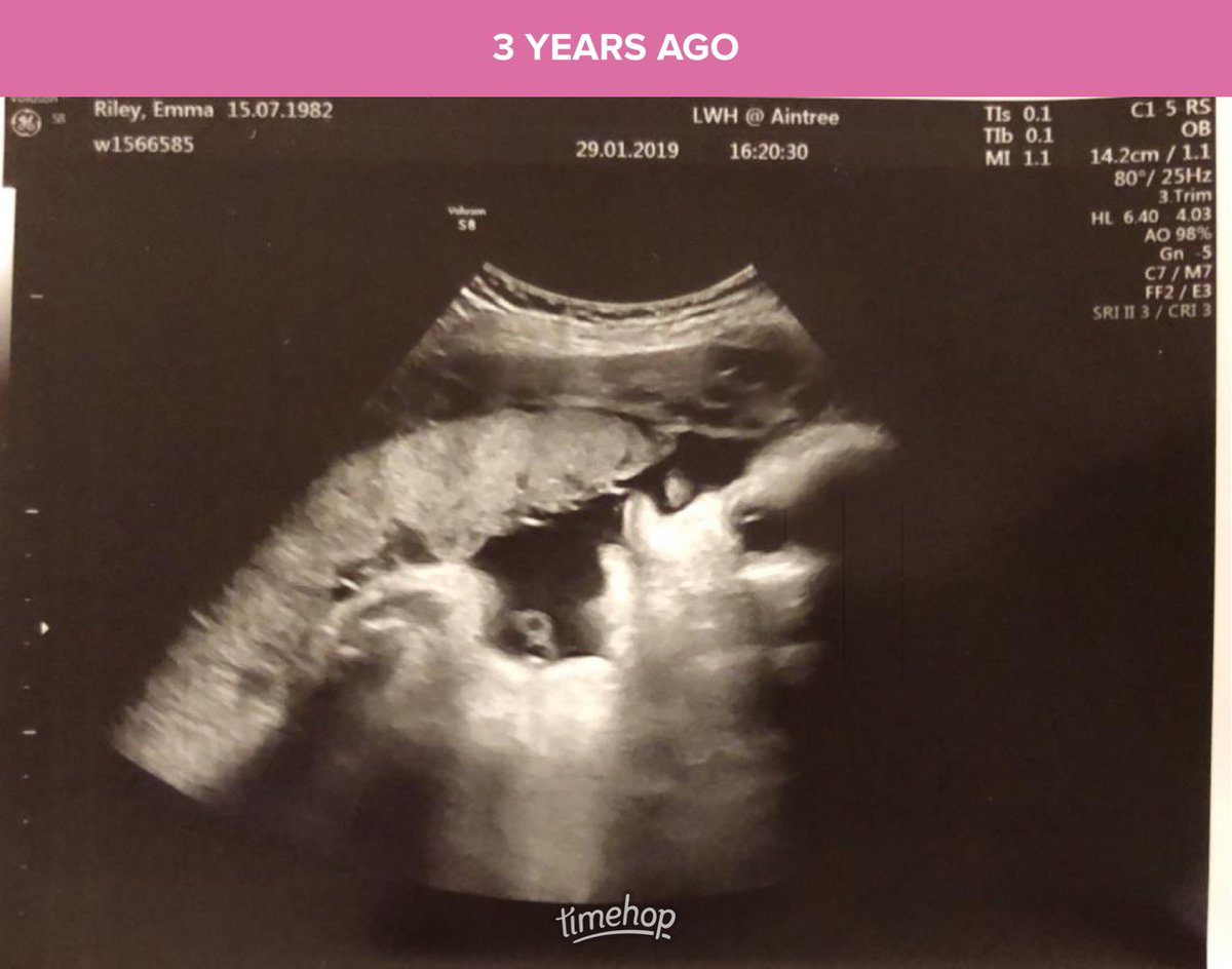 goggleboxemma tweet media