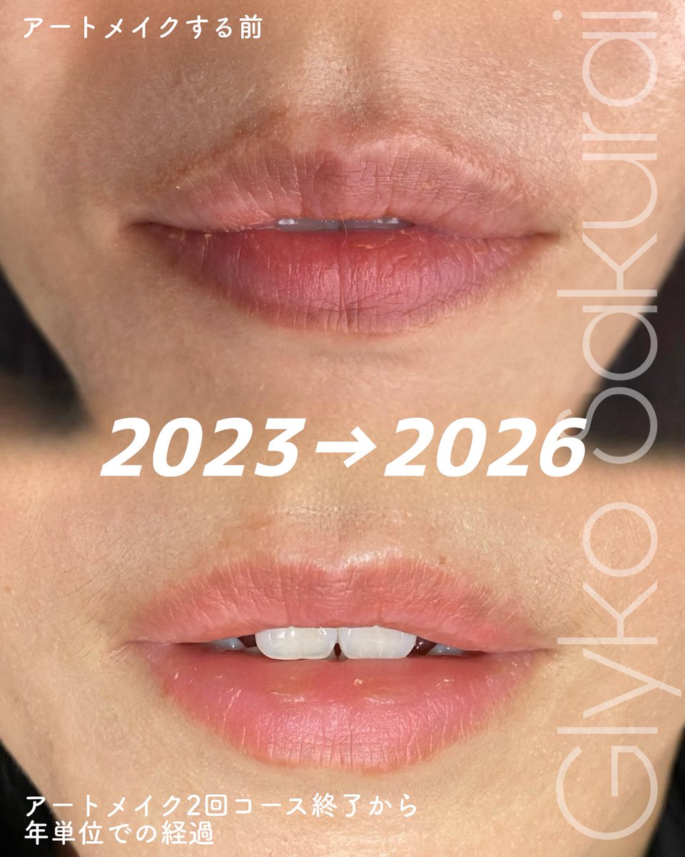 アートメイクしてる』ってわからないくらいの仕上がりにしておくことが