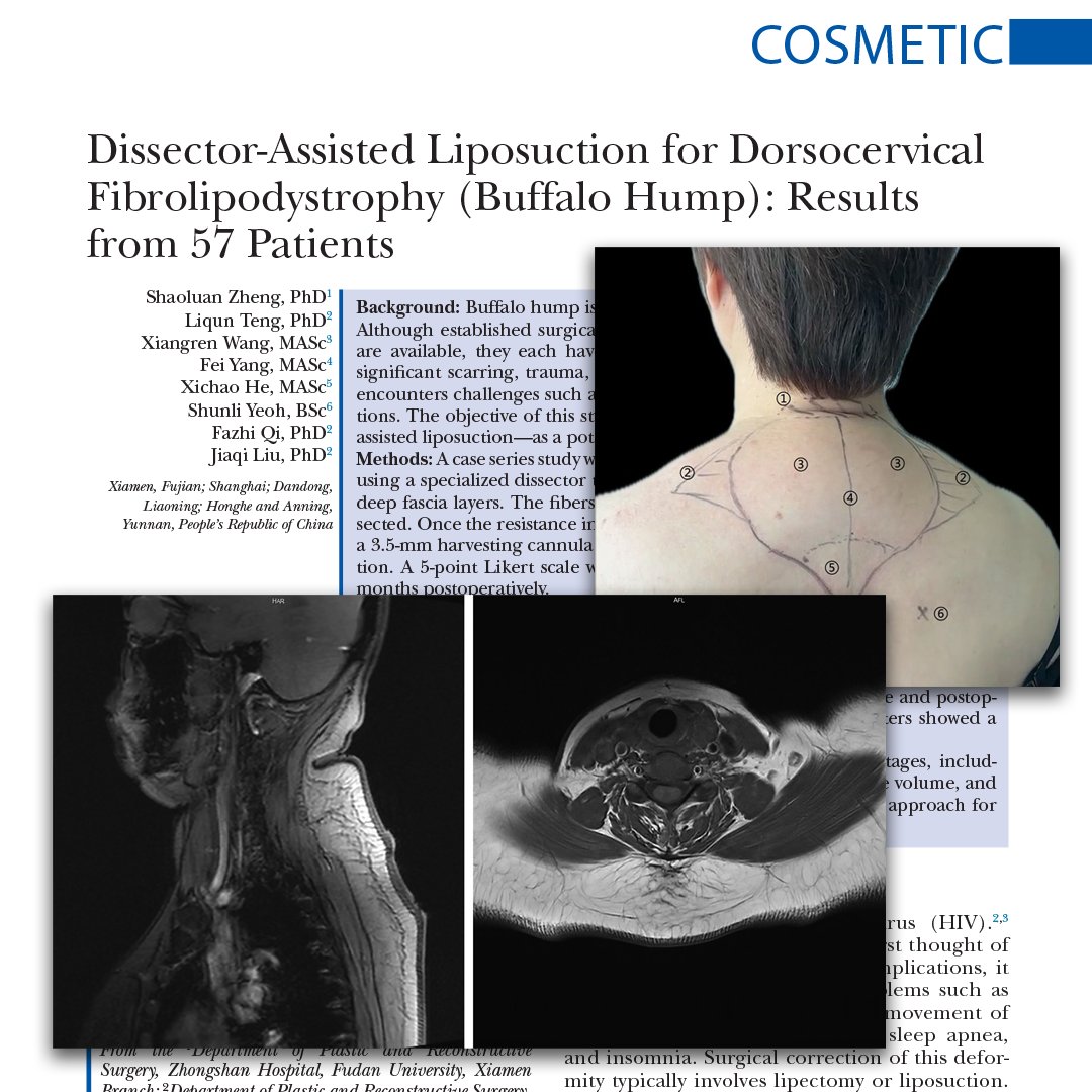 Plastic and Reconstructive Surgery tweet media