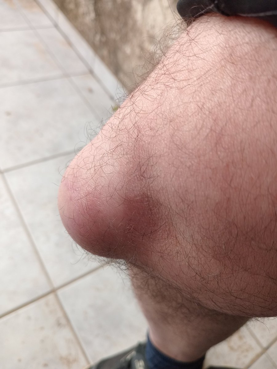 Por el amor de Dios🙏 suplico de rodillas que me den una mano🙏
Soy víctima de una persecución sin precedentes por denunciar corrupción,narcotráfico y no aceptar sobres.
Discapacitado con enfermedades incurables necesito una limosna para sobrevivir.
Alias
ASIA.CUERO.MOTO