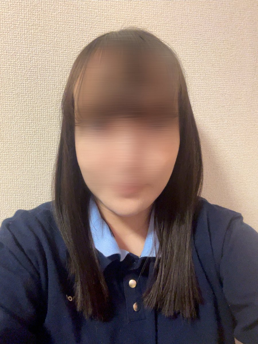 ft9575's tweet photo. 骨切りしてから3ヶ月経ちました。途中で不安な時もあったのですがいつも優しく対応してくださり本当に感謝しています😭
術前と比べると顔が小さくなったのがわかり嬉しいです。
大きな腫れは引いたのでまだこれから腫れが引くといいなと思っています。 https://t.co/qvNS819khz