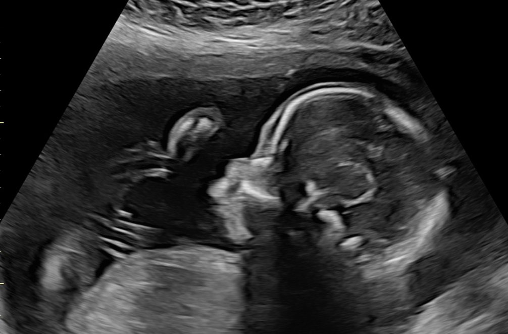 Dennis V. Perepelitsa 🇺🇦🇺🇲 tweet media