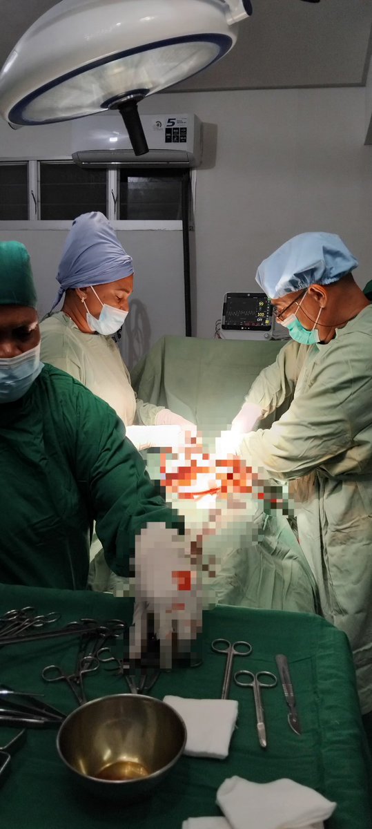 El Dr. Leandro Núñez, especialista en Ginecobstetricia, junto a la Lic. Yumaida Sariol, instrumentista, ambos integrantes de la #BMCTL en el #HROecusse, realizan cirugía ginecológica electiva con profesionalidad, coordinación y compromiso.
#CubaPorLaVida #CubaCoopera