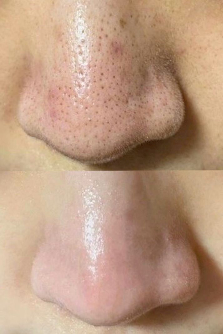 課金ちゃん tweet media