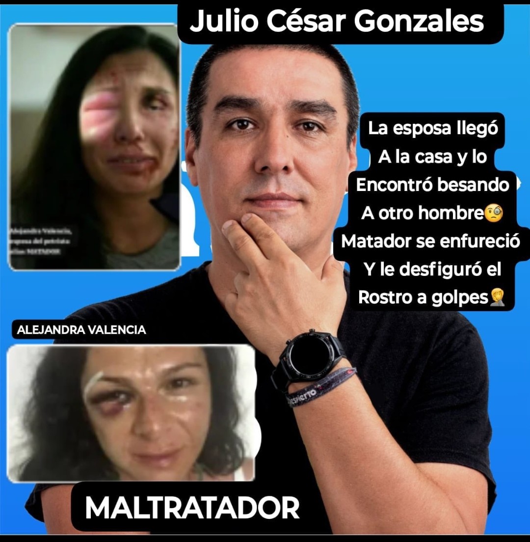 Ah, cómo asi, es que además de maricon también es asesino, con razón el casi feminicidio.
Ni un sólo voto por éste aspirante a senador.
Cepeda Roy Benedetti Sarabia Petróleo Uribestias TRUMP USA Elecciones #LaCasaDeLosFamosososCol3 #PetroVergüenzaMundial