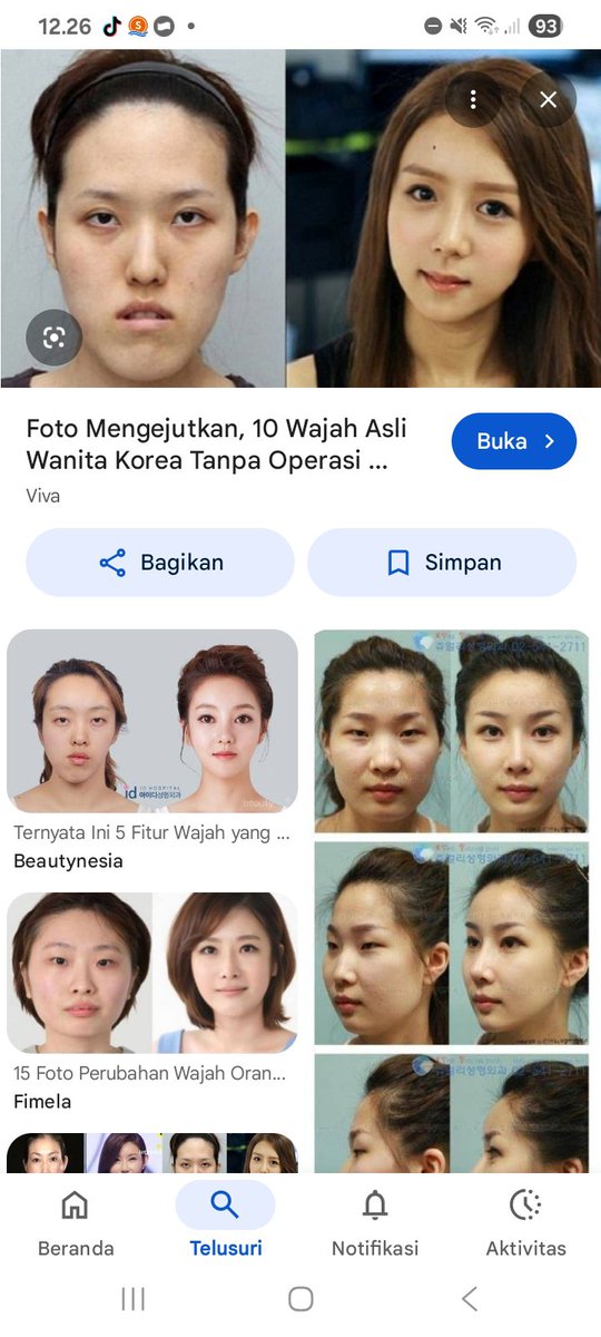 del11051's tweet photo. @sosinang1234 sepertinya wajah dan otakmu tersenggol saat operasi sehingga sekarang kamu berlagak seperti orng paling sempurna, gen negara asalmu benar benar jelek, wajah kotak dan gigi maju ituu ternyata tidak lebih baik setelah operasi https://t.co/XB7J7nkZoN