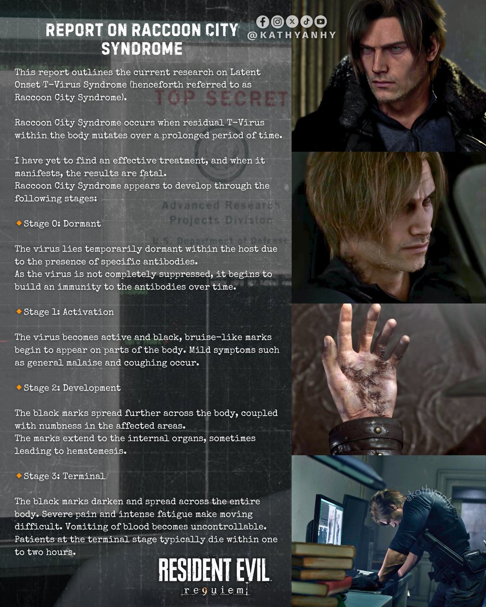 kathyanhy's tweet photo. Raccoon City Syndrome | Leon S. Kennedy confirmed infected in Resident Evil Requiem 🧬

Raccoon City Syndrome, clinically known as Latent Onset T-Virus Syndrome, affects survivors of the 1998 catastrophe. It develops when residual T-virus in the body mutates after a prolonged period, and there is still no effective treatment: its manifestation is fatal.

The disease progresses in four stages:

🔸 Stage 0 (Inactive/Dormant): The virus remains dormant thanks to specific antibodies, but develops immunity to them over time.

🔸 Stage 1 (Activation): Black marks similar to bruises appear, accompanied by general malaise and coughing.

🔸 Stage 2 (Development): The marks spread throughout the body and internal organs, causing numbness and, in some cases, hematemesis.

🔸 Stage 3 (Terminal): The marks darken and cover the entire body; intense pain, extreme fatigue, and uncontrollable vomiting of blood occur, with death within 1 to 2 hours.

The urgency indicated by Sherry suggests that Leon is in or about to enter stage 3, although she is also wearing gloves and could be infected: "Leon, we're running out of time."

The only one who would be free of this infection is Jill Valentine, who developed powerful antibodies against the T-virus after cryogenesis in Resident Evil 5 and managed to eliminate it completely. In addition, it is reported that by 2026, six survivors have already died, 30 years after their initial exposure to the virus in Raccoon City.

What other survivors might be going through this?

#ResidentEvilRequiem #REBHFun #LeonKennedy #GraceAshcroft #ResidentEvil