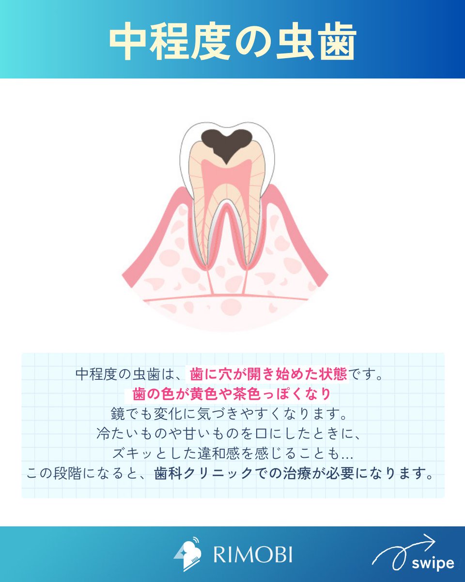 RIMOBI(リモビ)｜DENNOVATE(ディノベート)取扱 (@rimobi_dental