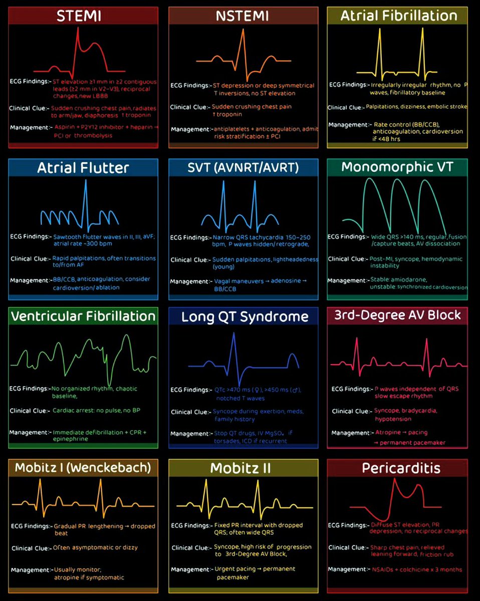 TrackYourHeart's tweet image. ECG Cheat Sheet: Master 12 Common Cardiac Conditions in One Image