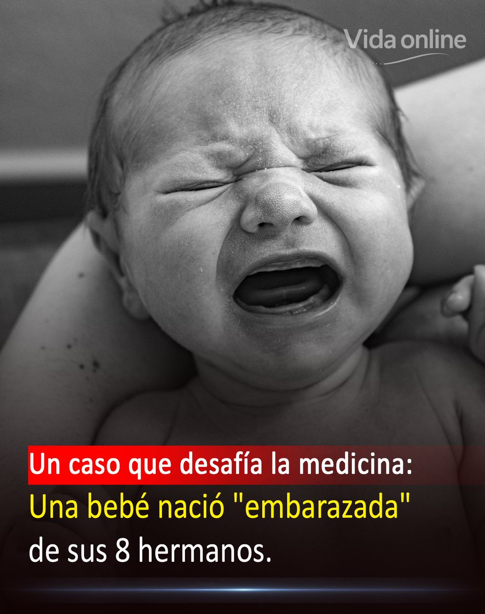 Imagina nacer con un misterio médico en tu interior. Esto le ocurrió a una bebé de solo un día de nacida .

Los médicos notaron un bulto duro en su abdomen y pensaron, erróneamente, que se trataba de un simple quiste benigno.

Sin embargo, la cirugía reveló algo insólito: no era
