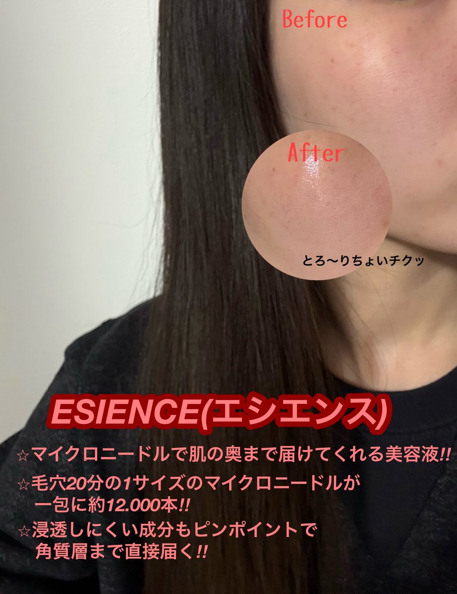 beauty__1717's tweet photo. 『ESIENCE(エシエンス)』※PR
生ビタミンC×生アゼライン酸 ダーマインショット200🪡
https://t.co/WXI7zsQF8o
#PR
#ESIENCE #エシエンス #ダーマインショット200使用してみた
#ビタミンC #ダーマインショット200 #ダーマインショット https://t.co/6rP6N9f6UK