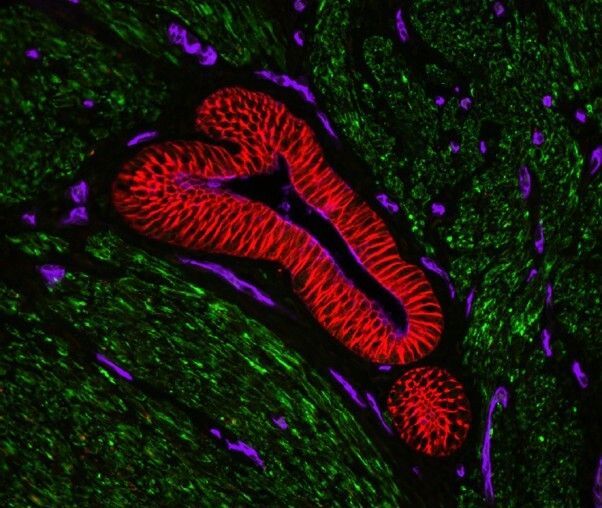 2BScientific's tweet photo. Fluorescent imaging? VECTASHIELD® Vibrance LOVES reds 🔴

✔ Excellent fluorescence retention
✔ View slides in 1 hour
✔ Minimal bubbles &amp; retraction
✔ Store at room temp for weeks

Available in 2 ml &amp; 10 ml. Included in the TrueView® kit.
https://t.co/gb9n7vyBdK https://t.co/Sgir5jn5re