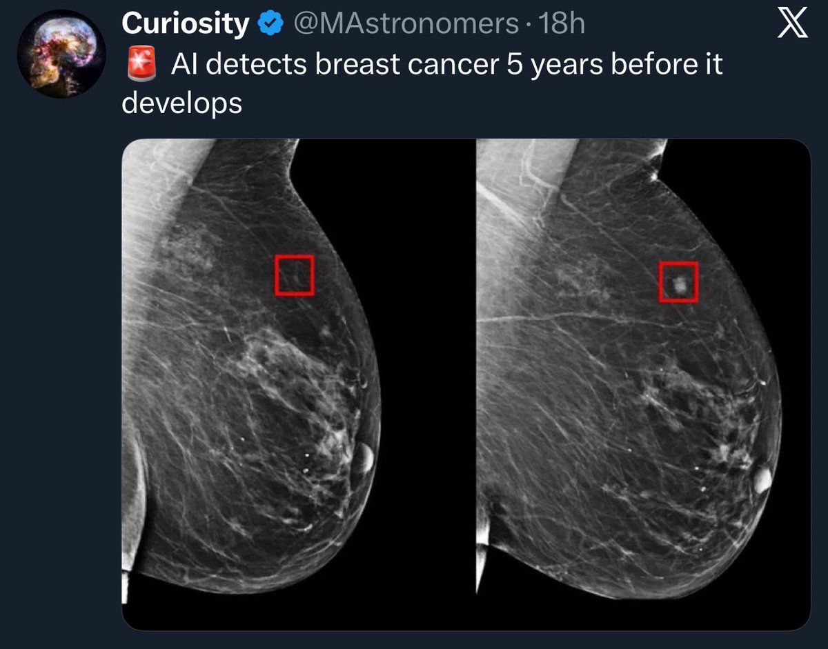 The future is here