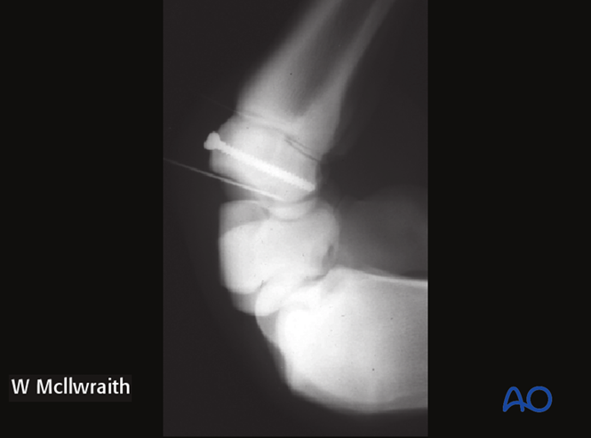 AO Surgery Reference tweet media