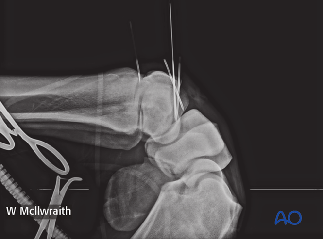 AO Surgery Reference tweet media