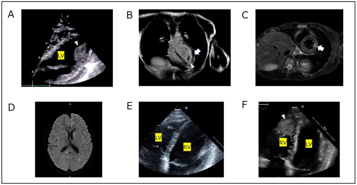 Hearts MDPI tweet media