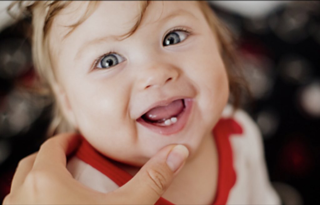 DeHealthguide's tweet image. Thread 🧵 you MUST read you can save a kid’s life.

SOME of you, despite being EDUCATED , remain ignorant about a misconception and a lie that lets children under 5 die avoidably.
Im here to fight that ignorance that kills those kids

Before you start reading, here are some key…