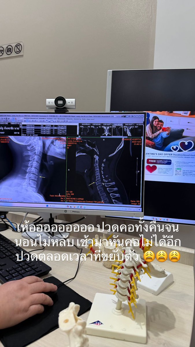 🗓️[13.02.2026] IGs : bb0un

เห้อออออออออ ปวดคอทั้งคืนจนนอนไม่หลับ
เช้ามาหันคอไม่ได้อีก ปวดตลอดเวลาที่ขยับตัว
😩😩😩

#bb0un