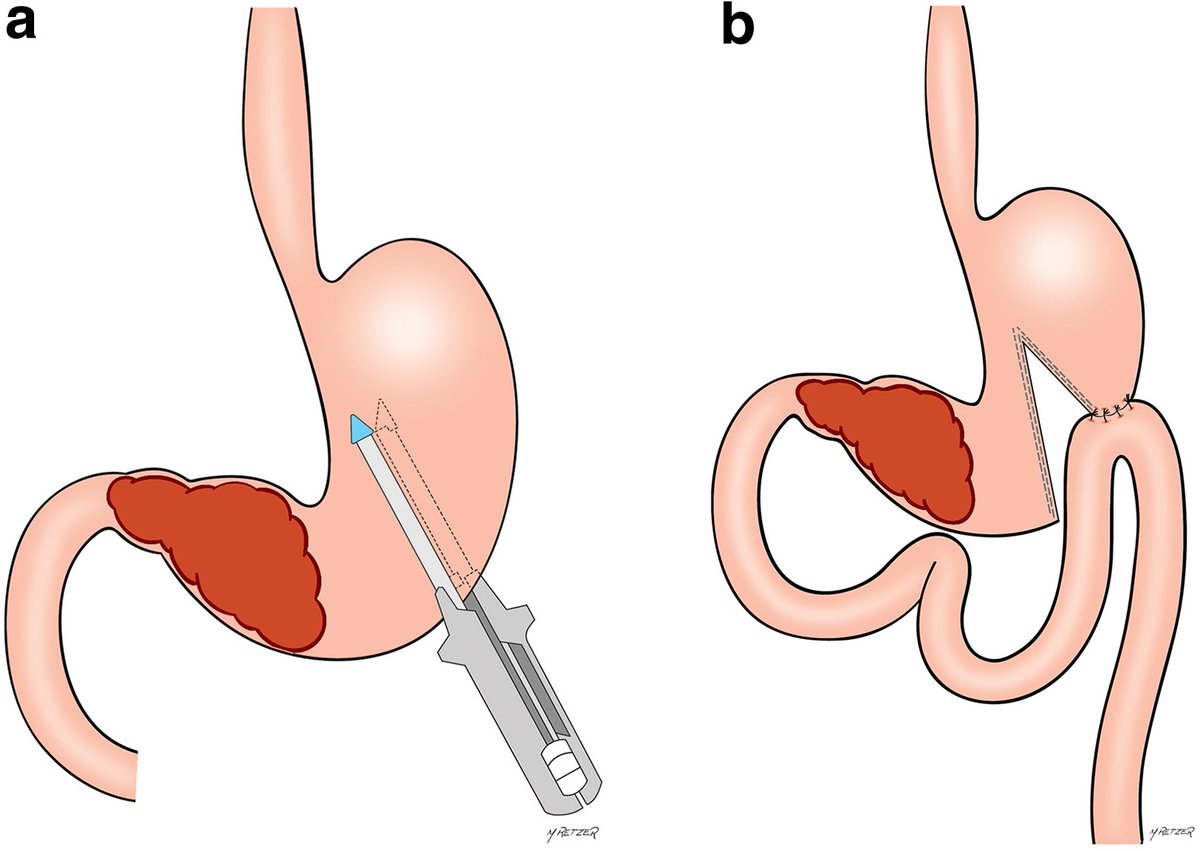 BJS Open tweet media