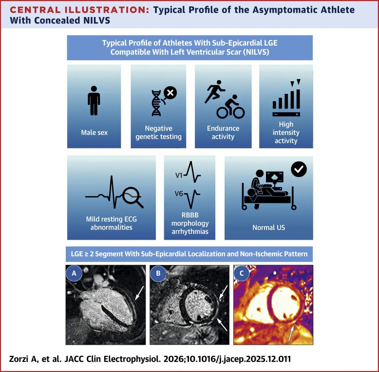 Isolated Nonischemic Left Ventricular Scar in Asymptomatic Athletes: Clinical Characteristics, Genetic Background, and Follow-Up
sciencedirect.com/science/articl…
#CMR #SCD #Sportscardiology #ACM
