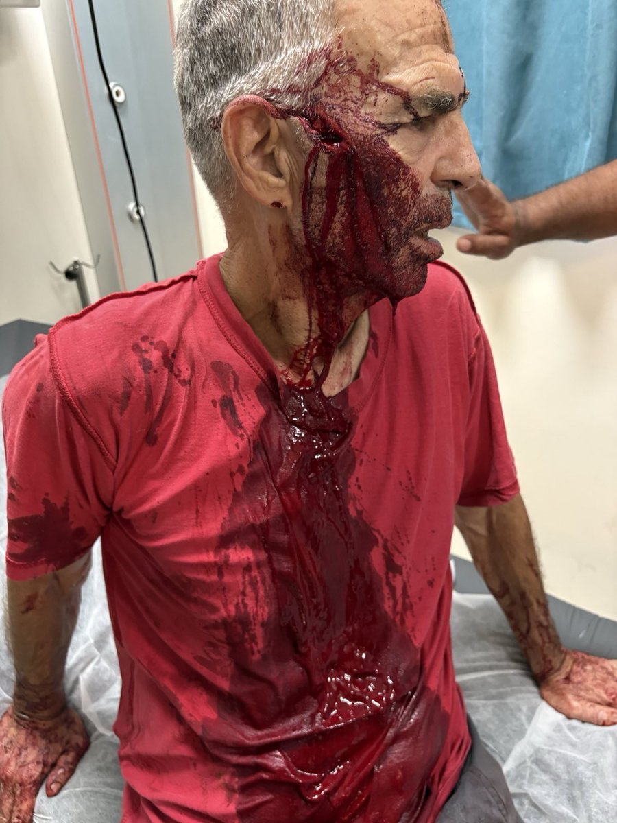 תראו מופתעים: התיק נגד אלה שניפצו את הגולגולת של אבא שלי נסגר תוך שבועיים. חוסר ראיות עאלק. אפילו לא הזמינו אותו לתת עדות. ככה נראית משטרה פוליטית