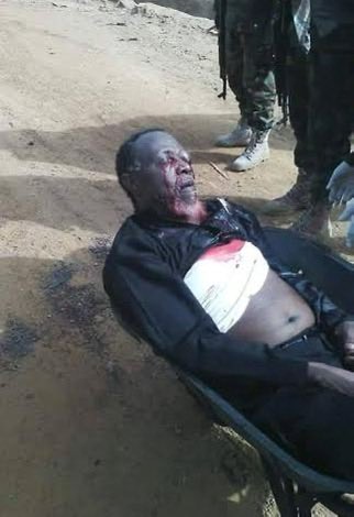 Before You Feel Sorry For Nasir el-Rufai 

Look at the attached photo very carefully. It is unedited. In case the notoriously short-memory Nigerian public has forgotten, this is what Nasir el-Rufai did to Sheikh Ibrahim el-Zakzaky when he was Governor of Kaduna State for eight