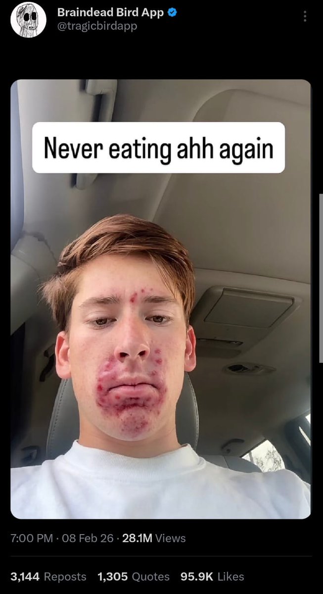 Bro ate the forbidden fruit 🍑 that has special 💦