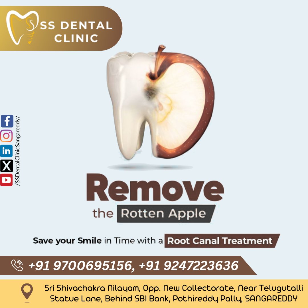 SSDentalClinics's tweet photo. #RootCanal #SaveYourTooth #DentalCare #Sangareddy #SSDentalClinic #PainlessDentistry #SangareddyDentist #ToothPainRelief #OralHealth #HealthySmile #DrShivaRamaKrishna #DrShivaratna #PothireddyPally #Endodontics #DentalWellness #SangareddyDistrict #ExpertDentist #TeethHealth https://t.co/uZFEDTO8JJ