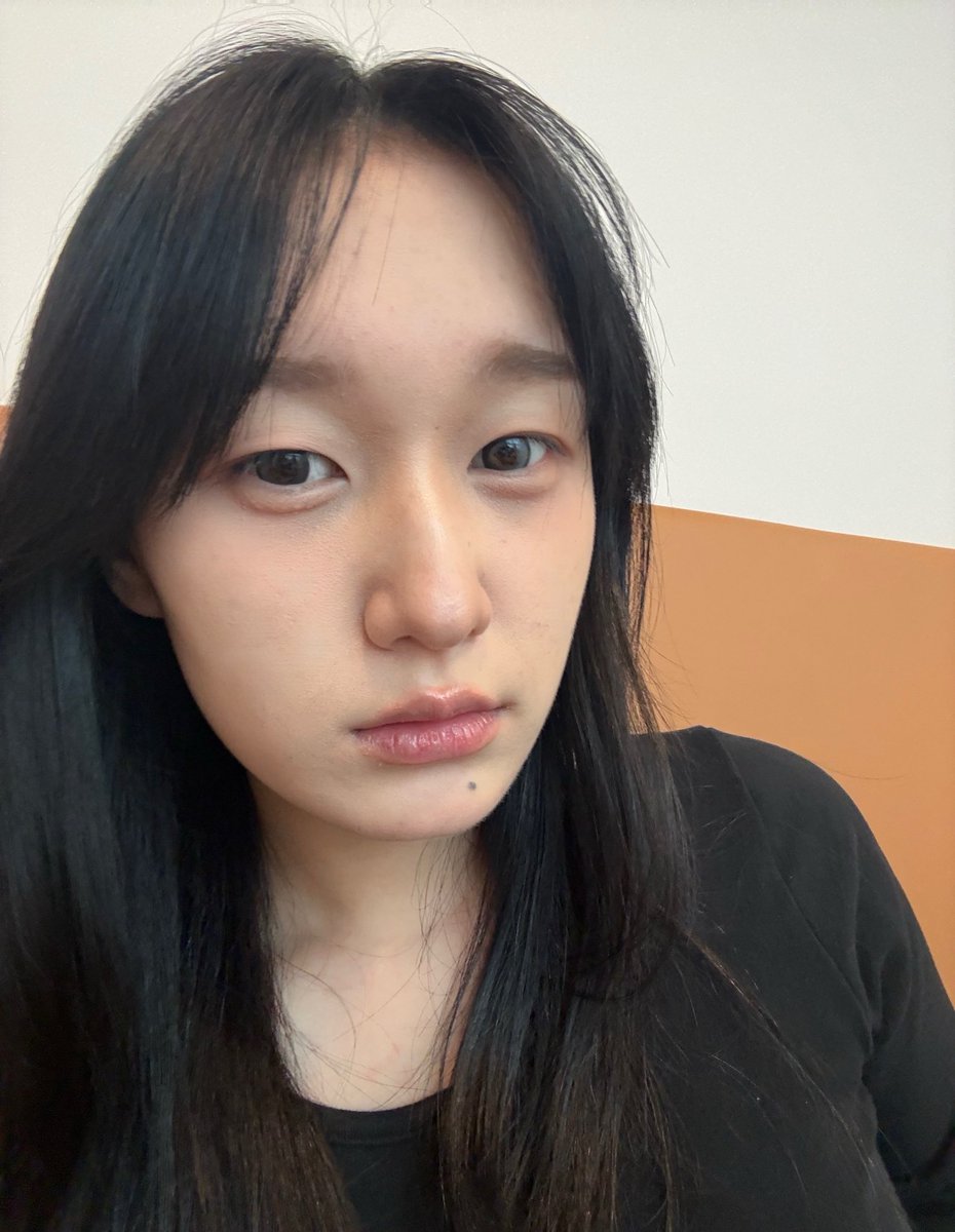 오렌즈 제발 축고정 렌즈 만들어줘